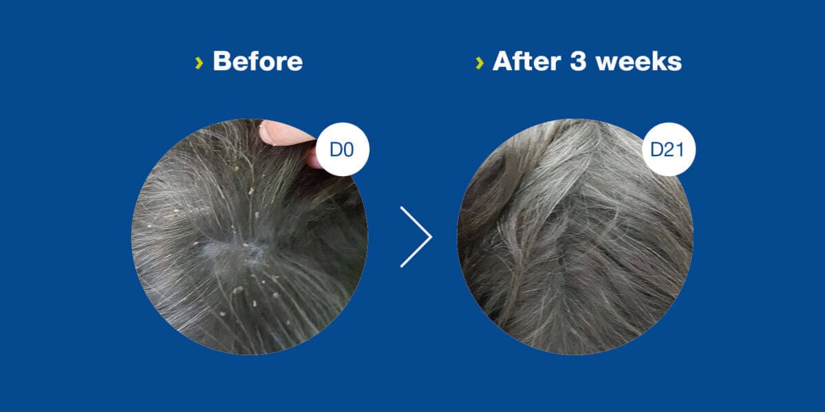 DOUXO S3 SEB Solution for oily to flaky skin For cats & dogs