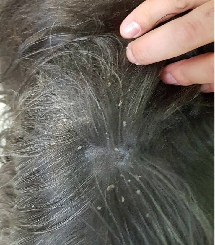Large flakes in a dog - dandruff