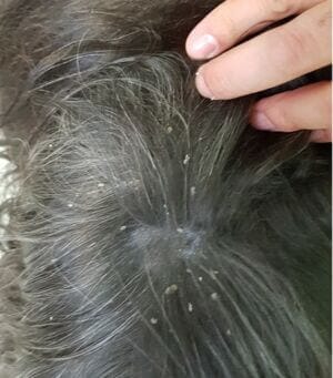 Large flakes in a dog - dandruff